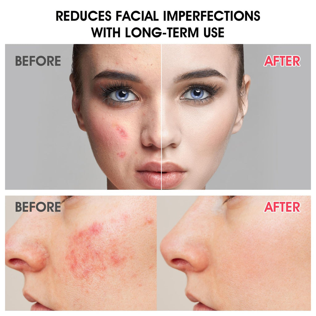 Alpha Arbutin Face Serum